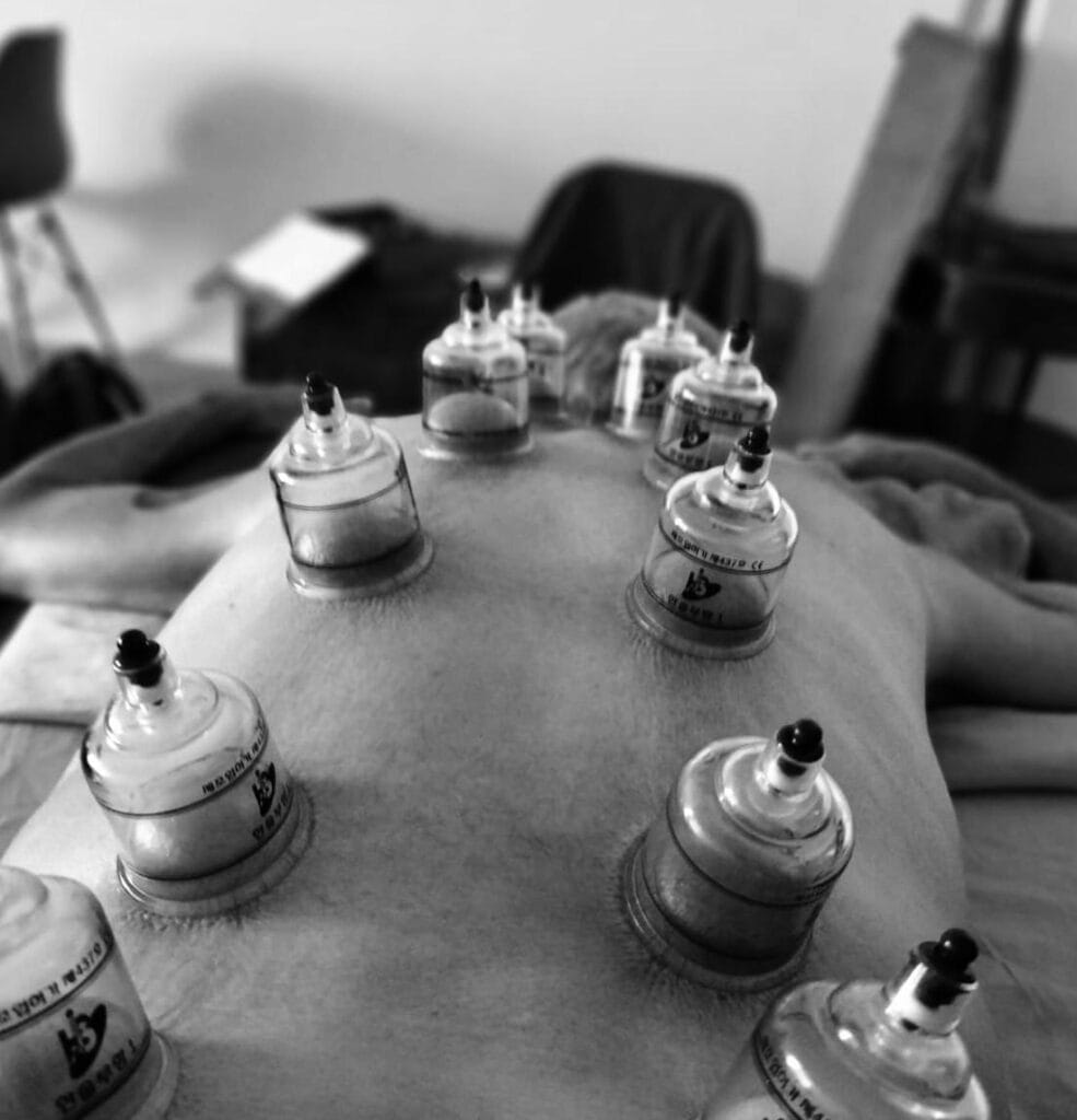 Ventousothérapie ou cupping